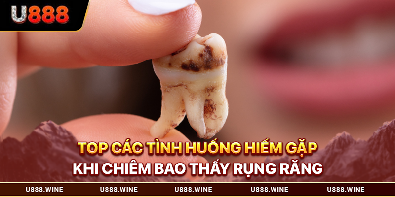 Mơ Thấy Rụng Răng Và Những Dữ Liệu Giải Mã Chi Tiết 2026 Top các tình huống hiếm gặp khi chiêm bao thấy rụng răng